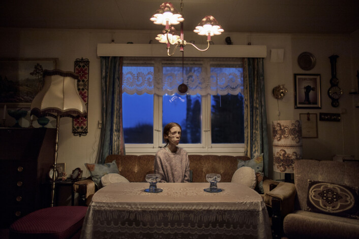 Årets portrett: 30 år gamle Lene Marie Fossen bor i boligen til bestefaren i Kolbu. Lene Marie lider av ekstrem anoreksi. Hun bruker fotografering som terapi, og har vært åpen om sykdommen. Hennes selvportretter og fotografier av flyktninger har vært stilt ut i blant annet Kristiansund. Foto: Espen Rasmussen Årets portrett: 30 år gamle Lene Marie Fossen bor i boligen til bestefaren i Kolbu. Lene Marie lider av ekstrem anoreksi. Hun bruker fotografering som terapi, og har vært åpen om sykdommen. Hennes selvportretter og fotografier av flyktninger har vært stilt ut i blant annet Kristiansund. Foto: Espen Rasmussen