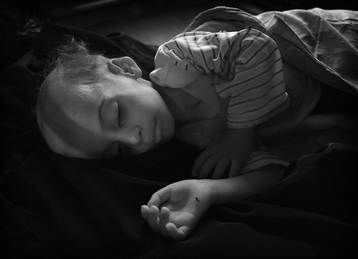 Ahmed er 1 år 2 mnd. og veier 6,55 kg. Kritisk underernæring kan gi livstruende svikt i organer som lever og nyrer, og mange vil aldri vokse seg til normal størrelse. Foto: Harald Henden, VG Ahmed er 1 år 2 mnd. og veier 6,55 kg. Kritisk underernæring kan gi livstruende svikt i organer som lever og nyrer, og mange vil aldri vokse seg til normal størrelse. Foto: Harald Henden, VG