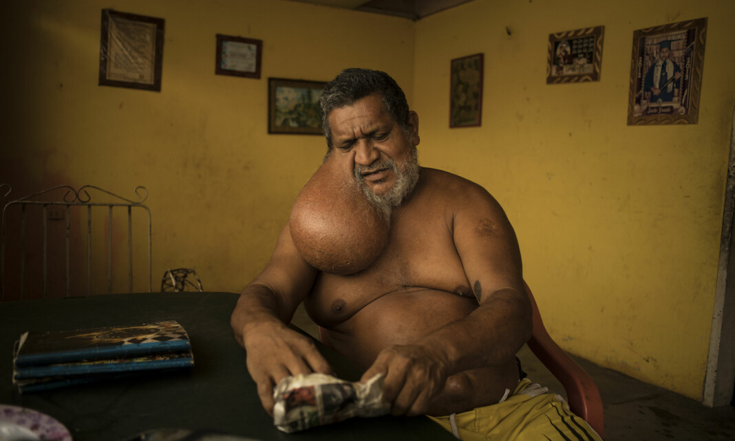 André Liohns bilder fra Venezuela kåret til beste nyhetsbilder fra utlandet