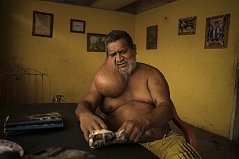 André Liohns bilder fra Venezuela kåret til beste nyhetsbilder fra utlandet