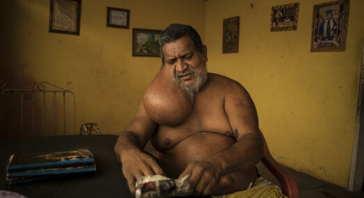 André Liohns bilder fra Venezuela kåret til beste nyhetsbilder fra utlandet André Liohns bilder fra Venezuela kåret til beste nyhetsbilder fra utlandet