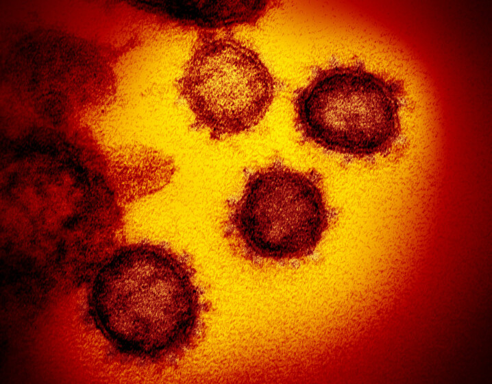 Russlands utenriksdepartement avviser anklagene som en «falsk historie». Bildet viser covid-19-viruset sett gjennom et mikroskop.