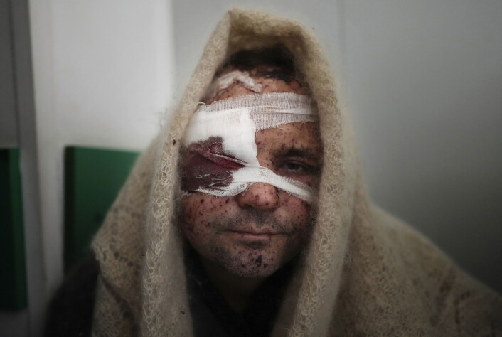41 år gamle Serhij Kralja ble såret under et russisk angrep mot Mariupol. 41 år gamle Serhij Kralja ble såret under et russisk angrep mot Mariupol.
