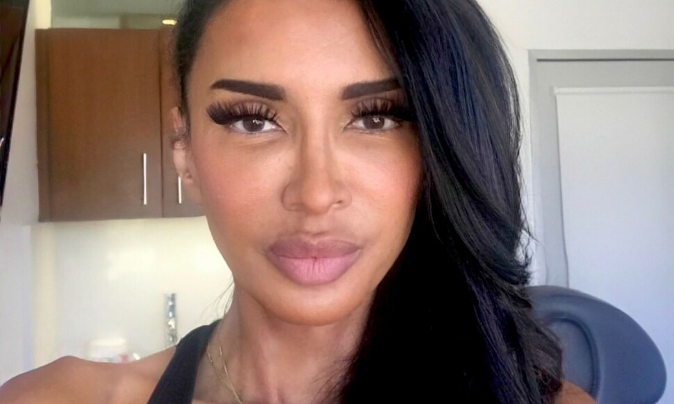 Dureks søster om møtet med VG