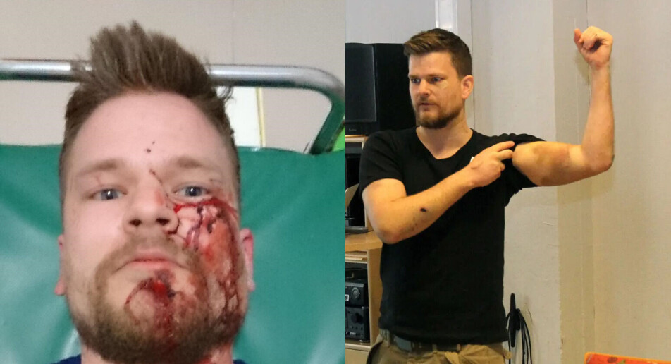 Ble brutalt angrepet i 2016 – nå får Øystein Windstad erstatning